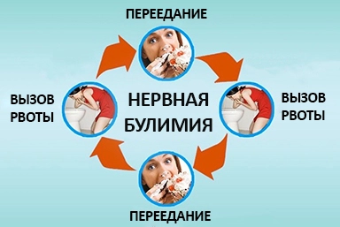 Лечение булимии в Днепре